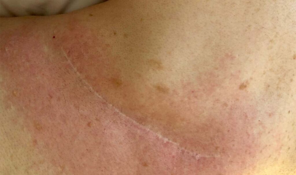 Before image