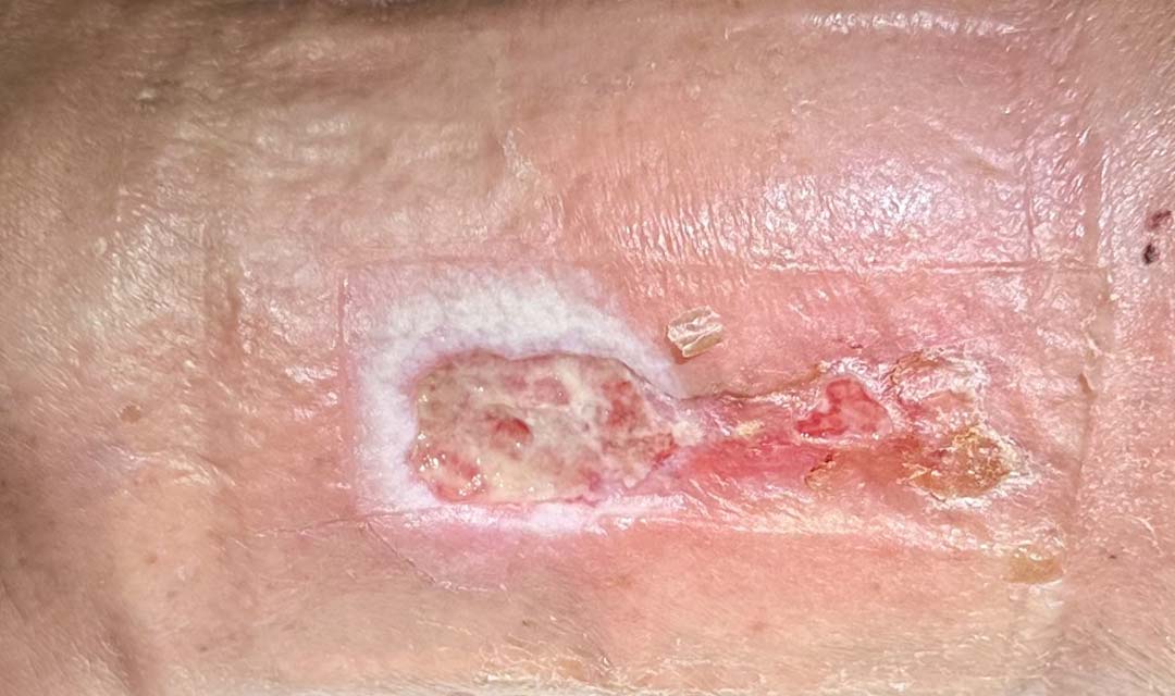 Before image